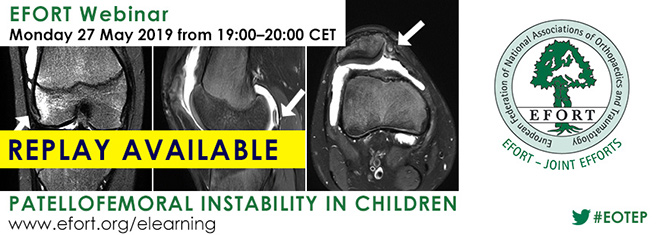 Efort Welcome - replay paediatrics webinar 0519 b660x235